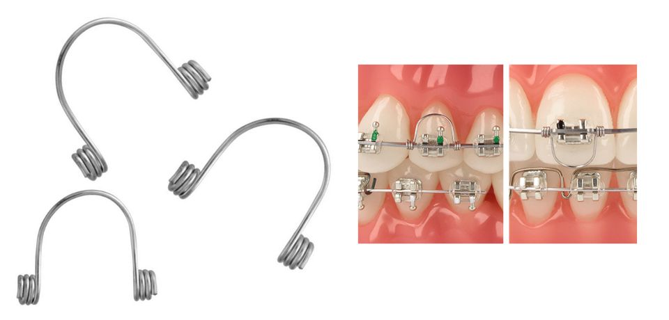 thumbnail image 2 of 10pcs Dental Orthodontic Torquing Anterior Teeth Wire – Rectangular Spring 1825 2 of 5