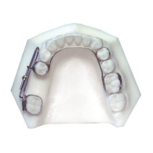 Mesial Jet