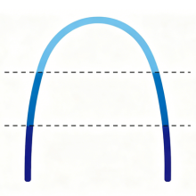 Stepped-Force NiTi Archwires